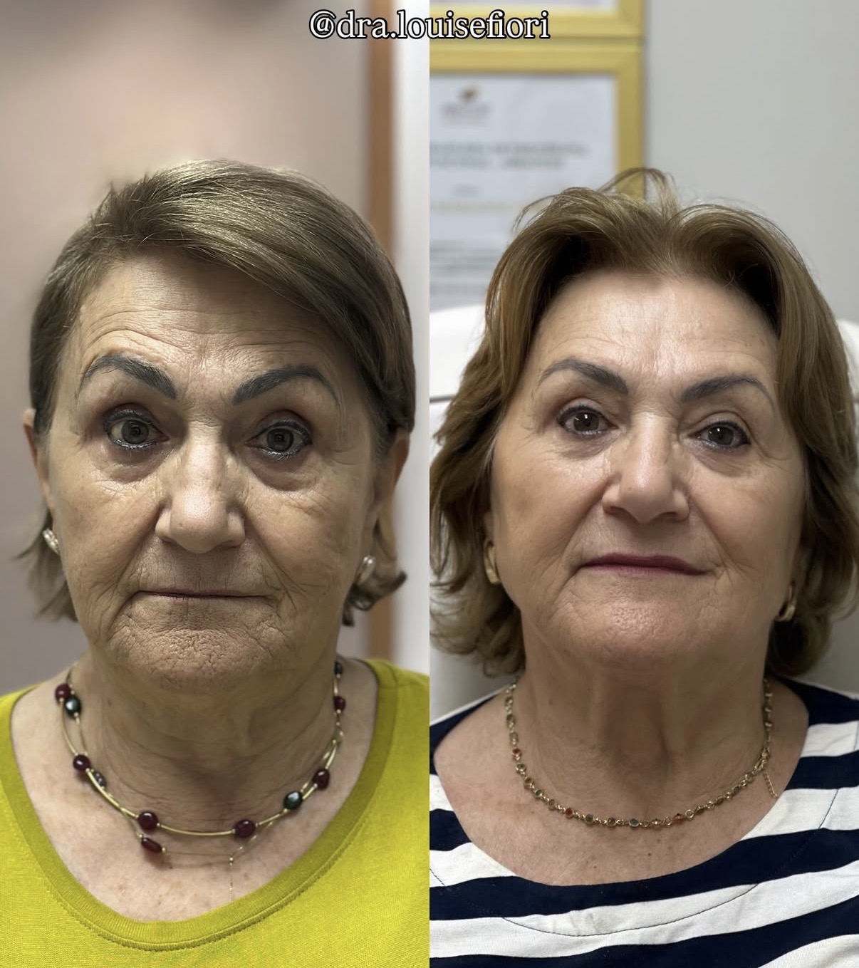 Dra. Louise Fiori