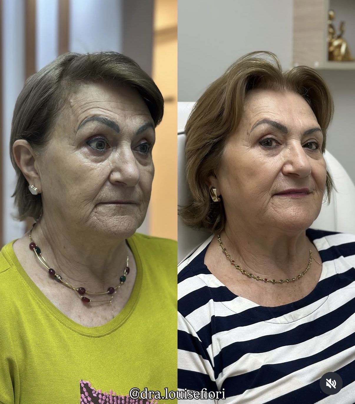Dra. Louise Fiori